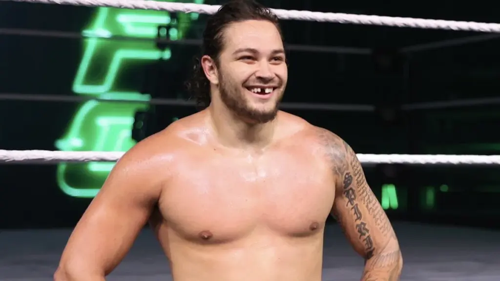 Shiloh Hill Reveals Origin of His Missing Tooth